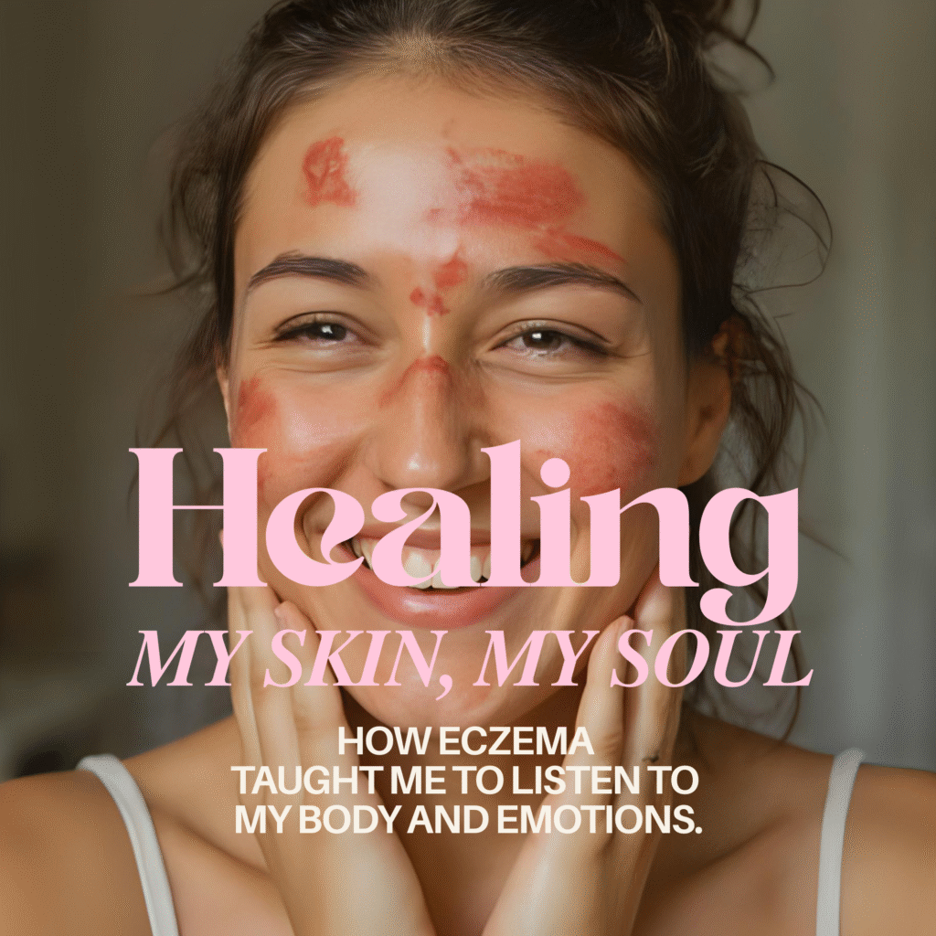 Woman with visible eczema patches on her face smiling, with text “Healing My Skin, My Soul – How Eczema Taught Me to Listen to My Body and Emotions.”