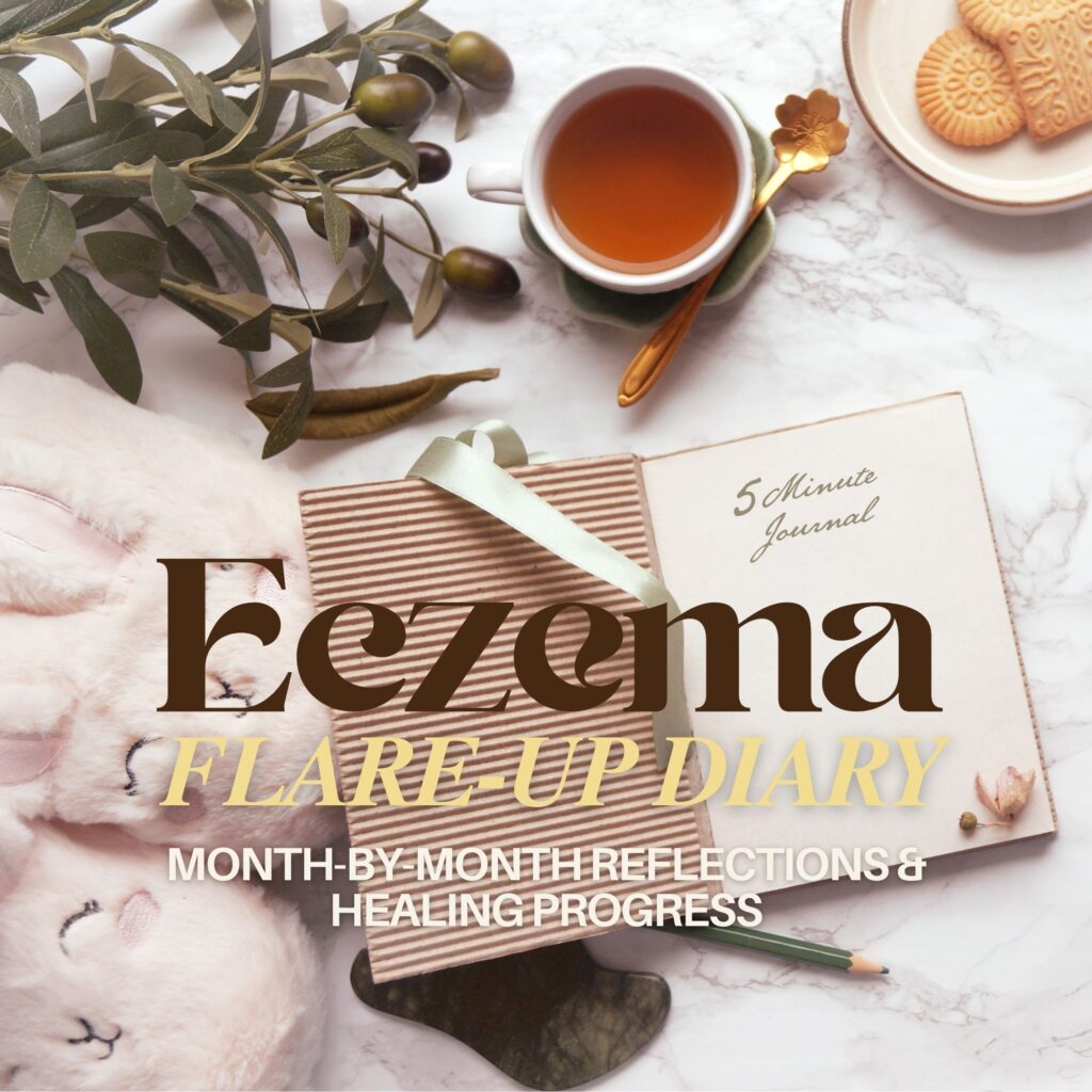 Flat lay of a journal, tea, cookies, and bunny slippers, styled for cozy eczema tracking.